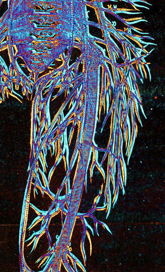 [Fig .. course of nerves: nervorum delineatio, Vesalius alone, Geminus alone, 
						superposition; magnification of an area in thigh]